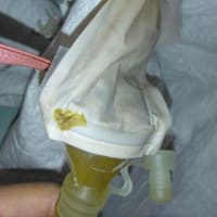 経過報告　④　もう少しだったのにー😢
