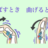 「バネ指」が女性に多いのには理由があります