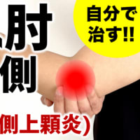 自分で治す！【テニス肘・外側上顆炎】肘の外側の痛みの治し方・セルフケア