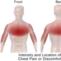 胸痛：ワクチンによる障害報告のレビュー