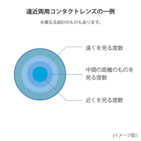遠近両用ソフトコンタクトレンズとその問題