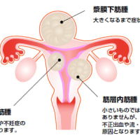 叔母からのアドバイス