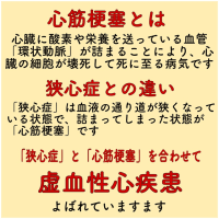 激増　心筋梗塞　若い人も