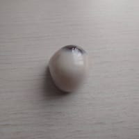 私の義眼の場合