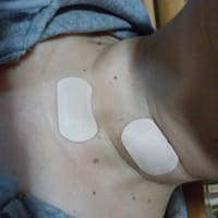 甲状腺