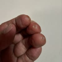 懐かしい指の痛み