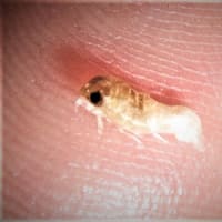 125 サヨリヤドリムシなど海の寄生虫 チリモン プチモン写真館
