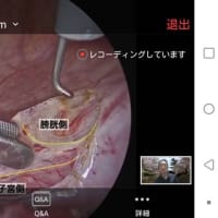 子宮内膜症はなぜ手遅れになるまで見つからないのか その4 ラパロスコピストの夢 子宮内膜症はなぜ手遅れになるまで見つからないのか その4 ラパロスコピストの夢