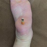 眠りやすくなるツボ