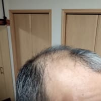 育毛剤　vol.3