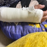 手術