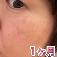 【本当に消えました‼️（追加：比較写真）】