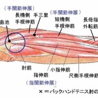 バックハンドテニス肘の針灸治療 ver.2.１