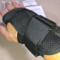 自分が交通事故に ～TFCC損傷