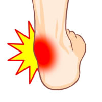 足首の痛みは股関節が引き起こすことがある