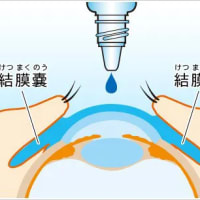 ２０２５/６/１２（木）＃二十四節気＃芒種７日＃満月１日東京都の光化学スモッグ注意報等の発令状況＃東京都区南部