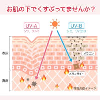 水面下でくすぶっている『〇〇』が根本原因？！