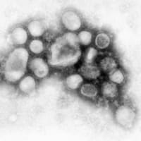 インフルエンザＡ（Ｈ１Ｎ１）関連７　潜伏期間は通常インフルエンザの倍？