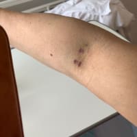 11日経ってやっと入院出来ました！
