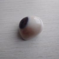 私の義眼の場合