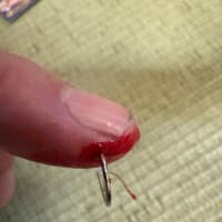 釣り針のカエシの威力身をもって知りました。