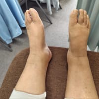 アロマの依頼