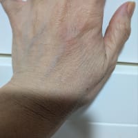 手が痛くて目が覚めた