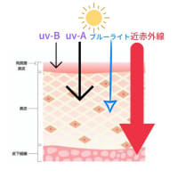 日焼けの原因は、紫外線だけじゃない！