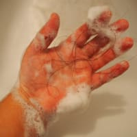 女性の薄毛、解決の鍵は頭皮にあり！