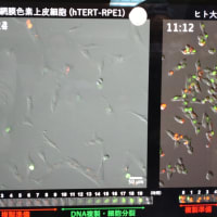 三島遺伝研　DNA 検出