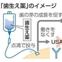 世界初の「歯生え薬」：京大病院で治験開始へ
