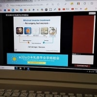 雨の夜も、嵐の前の静けさも