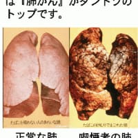 6年 私たちの体 肺胞とたばこの害 太田小学校児童情報委員会 学習のまとめ 方法や達成感 6年 私たちの体 肺胞とたばこの害 太田小学校児童情報委員会 学習のまとめ 方法や達成感