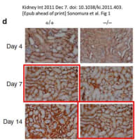 画像類似の論文#１６ （Kidney Int. 2011 Dec 7. doi: 10.1038/ki.2011.403. [Epub ahead of print]）
