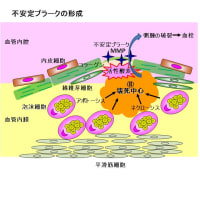 心筋梗塞を引き起こす動脈硬化の原因は活性酸素