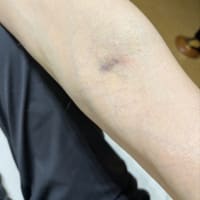 クリンへの想いは尽きなくて・・・309