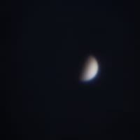 金星