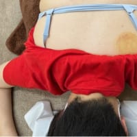 吸い玉：逆、逆、