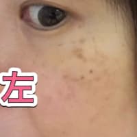 【本当に消えました‼️（追加：比較写真）】