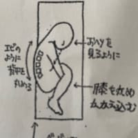 腰部脊柱管狭窄症　③