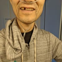 歯っ欠けジジイ。