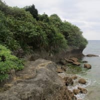 昏睡における瞳孔診察