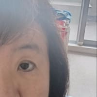 術後　２９日目