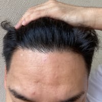 1年