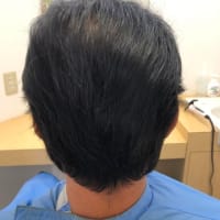 3D増毛エクステ