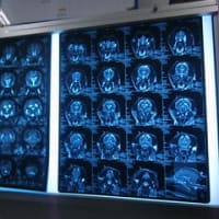 MRI & CT診断結果