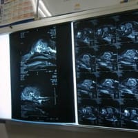 MRI & CT診断結果