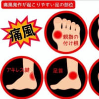 コン爺　またもや痛風か？😱💦