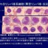 異型リンパ球 感染症内科への道標