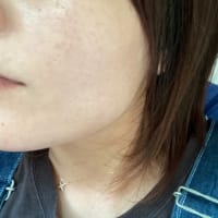 ハーブピーリング🌿DT終了